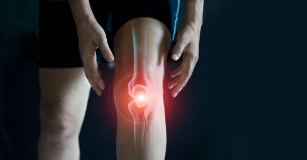 Osteoarthritis of the knee joint